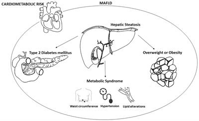 Metabolic dysfunction-associated fatty liver disease: current therapeutic strategies